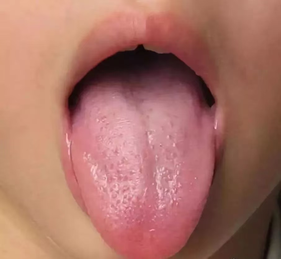 過度喂養(yǎng)危害大，寶寶發(fā)出的積食信號你能看懂多少？