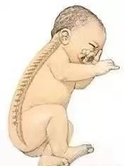 【母嬰知識】“頭”等大事，新生兒枕頭使用須知！