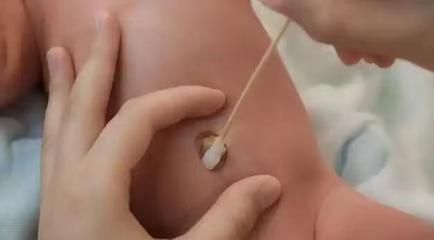  肚臍眼里的污垢，到底能不能摳？ 