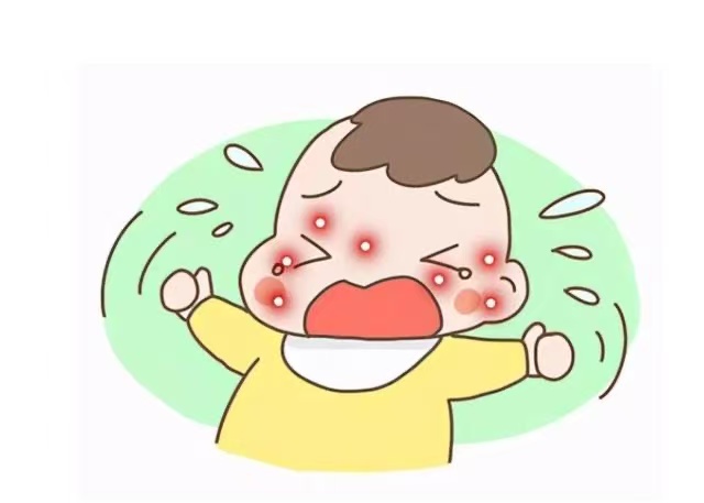 孩子濕疹反復(fù)發(fā)作怎么辦？這些防治方法請收好！